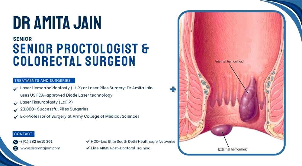 Dr Amita Jain Senior Proctologist and Colorectal Surgeon Delhi